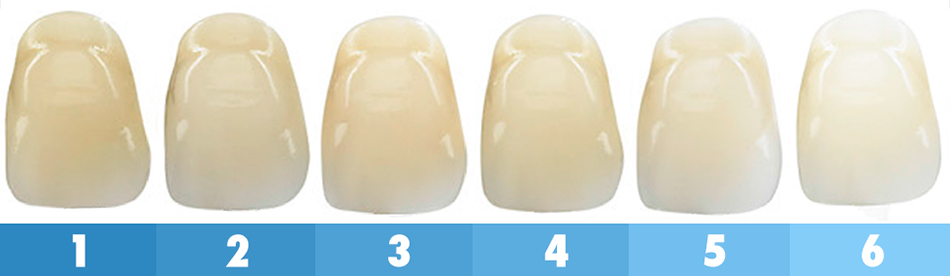 Test Power Swabs : le kit de blanchiment des dents promet un sourire de six nuances plus blanc en une semaine